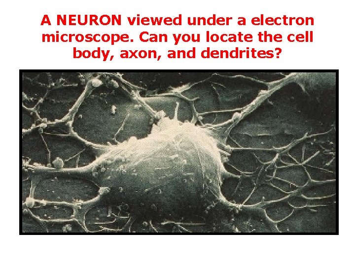 A NEURON viewed under a electron microscope. Can you locate the cell body, axon,