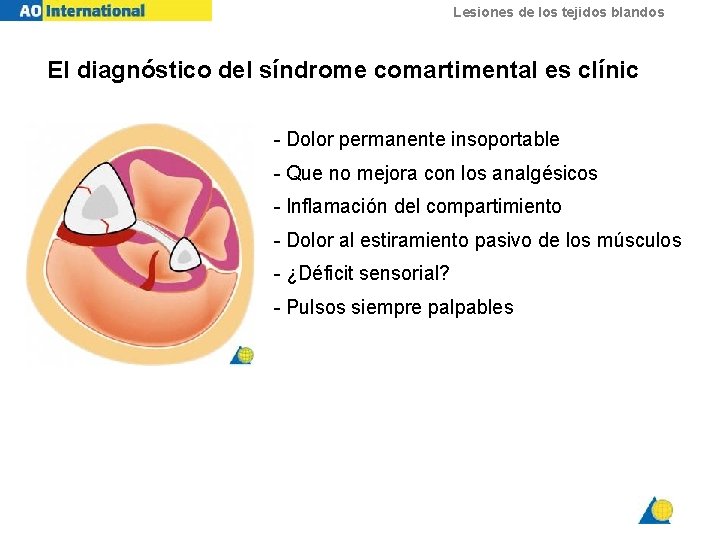 Lesiones de los tejidos blandos El diagnóstico del síndrome comartimental es clínic - Dolor