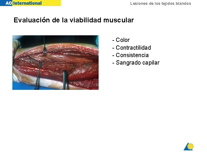 Lesiones de los tejidos blandos Evaluación de la viabilidad muscular - Color - Contractilidad
