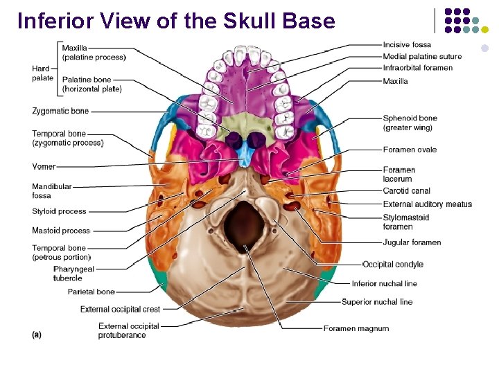 Inferior View of the Skull Base 