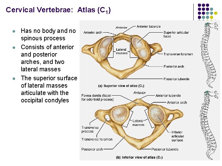 Cervical Vertebrae: Atlas (C 1) l l l Has no body and no spinous