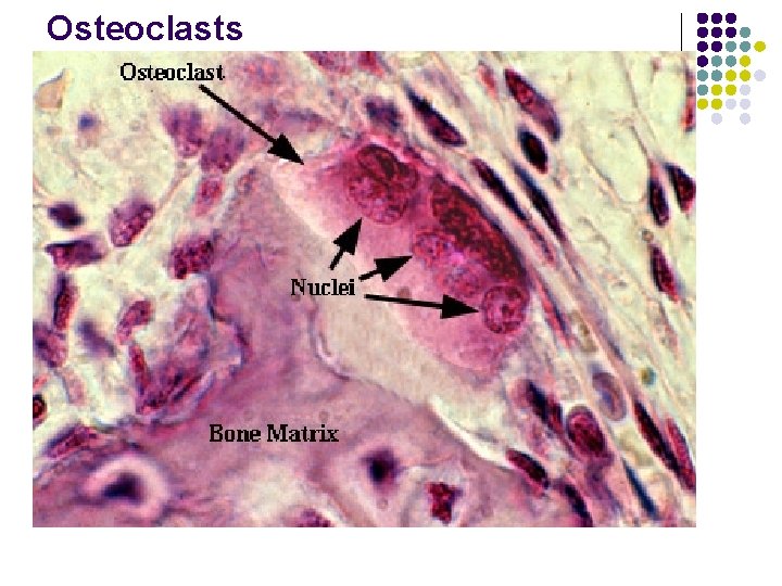 Osteoclasts 