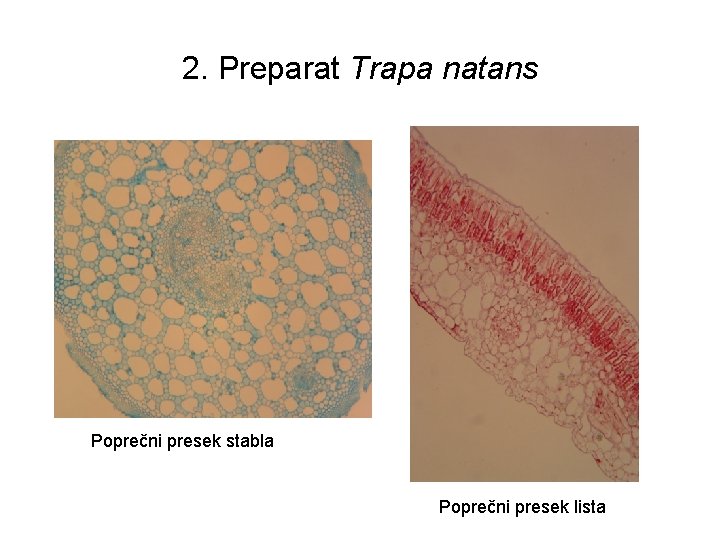 2. Preparat Trapa natans Poprečni presek stabla Poprečni presek lista 