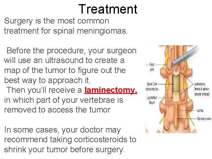Treatment Surgery is the most common treatment for spinal meningiomas. Before the procedure, your