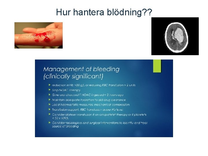 Hur hantera blödning? ? 