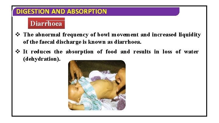 DIGESTION AND ABSORPTION Diarrhoea v The abnormal frequency of bowl movement and increased liquidity