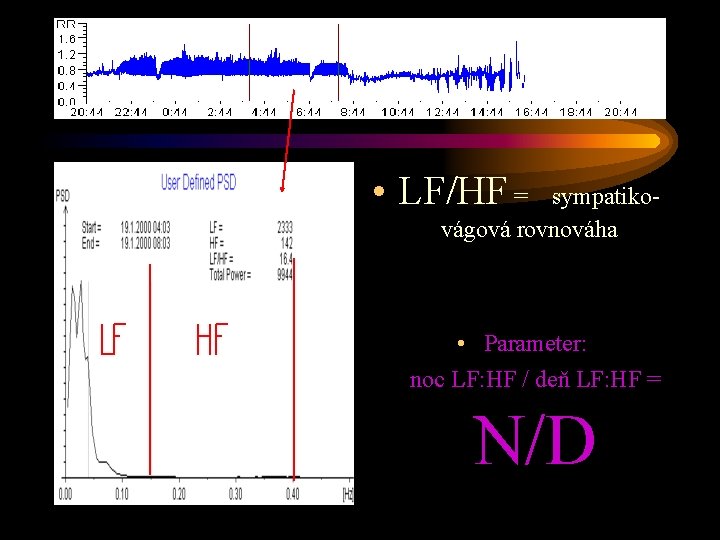  • LF/HF = sympatikovágová rovnováha • Parameter: noc LF: HF / deň LF: