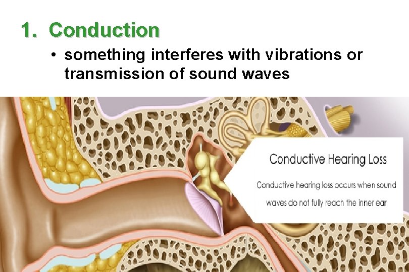 1. Conduction • something interferes with vibrations or transmission of sound waves 