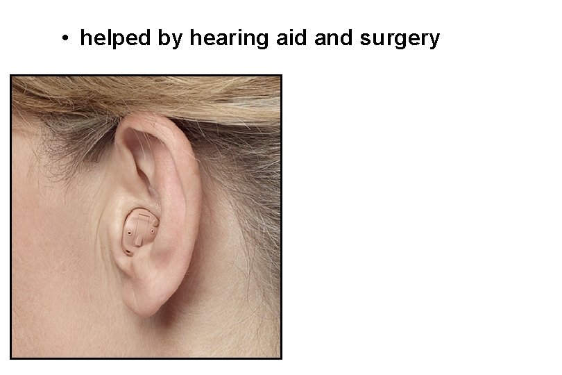  • helped by hearing aid and surgery 