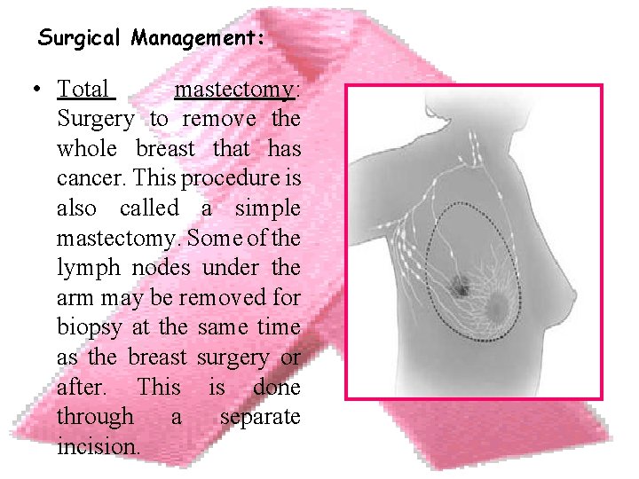 Surgical Management: • Total mastectomy: Surgery to remove the whole breast that has cancer.