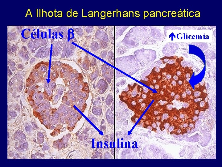 A Ilhota de Langerhans pancreática Células Glicemia Insulina 