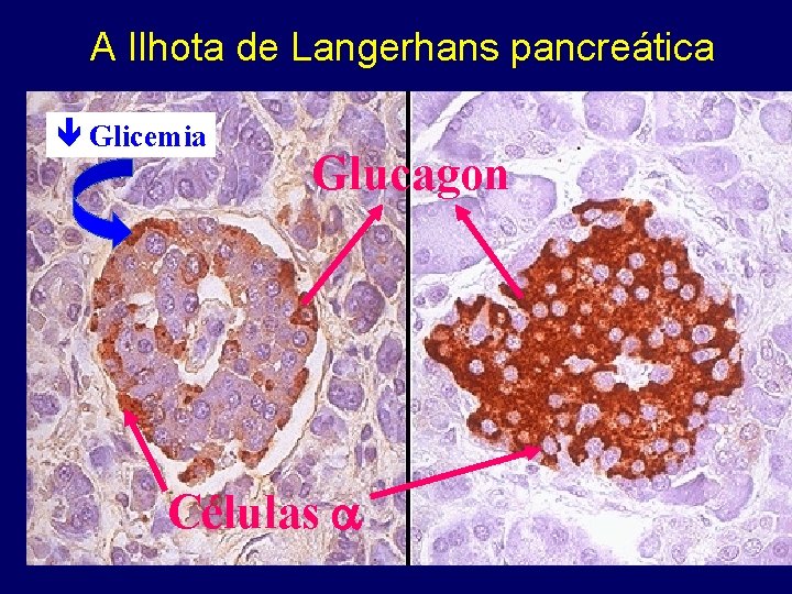 A Ilhota de Langerhans pancreática Glicemia Glucagon Células 