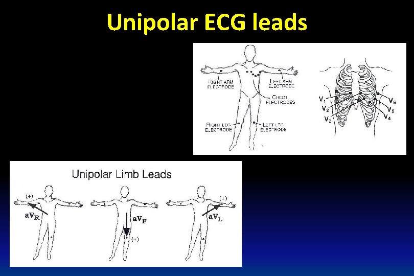 Unipolar ECG leads 