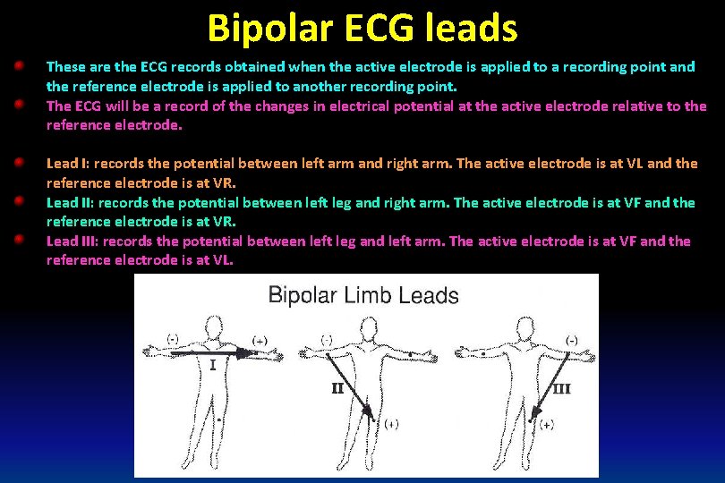 Bipolar ECG leads These are the ECG records obtained when the active electrode is