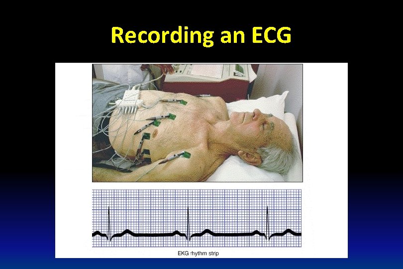Recording an ECG 