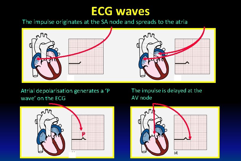 ECG waves The impulse originates at the SA node and spreads to the atria