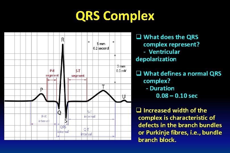 QRS Complex q What does the QRS complex represent? - Ventricular depolarization q What