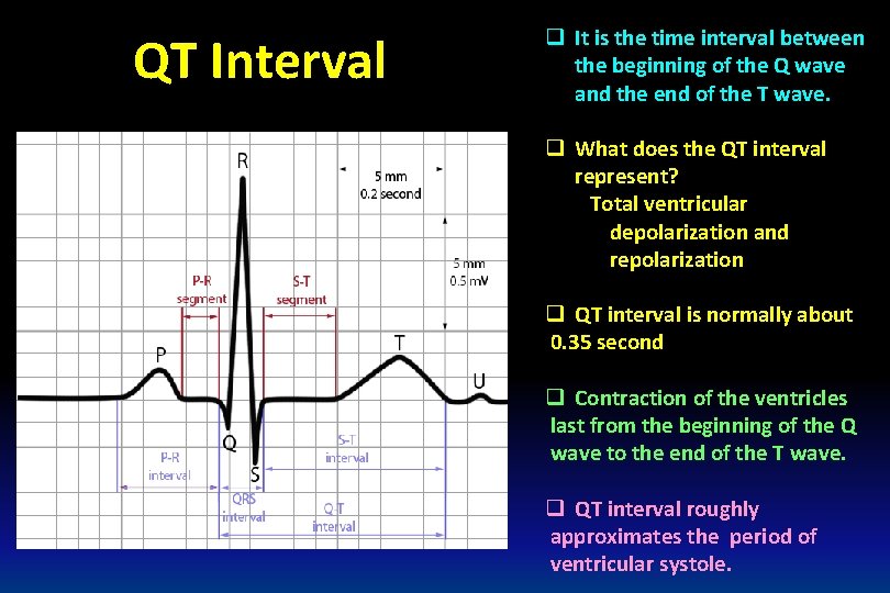 QT Interval q It is the time interval between the beginning of the Q