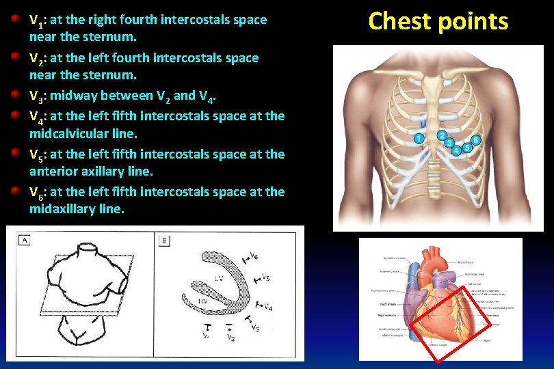V 1: at the right fourth intercostals space near the sternum. V 2: at