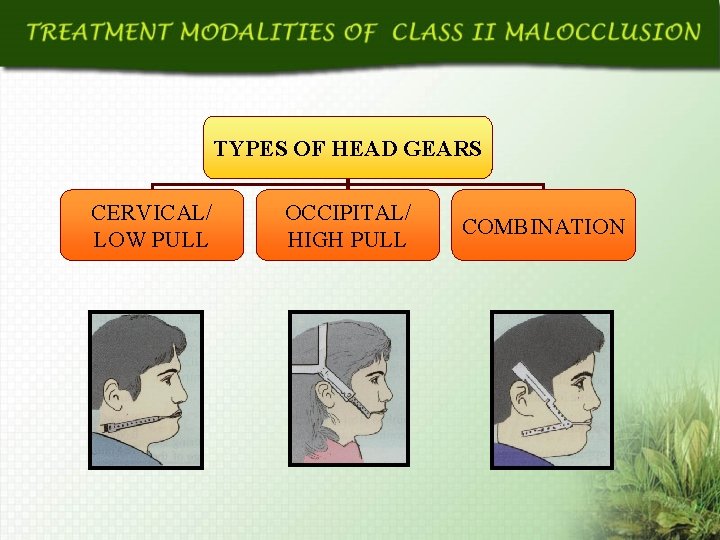 TYPES OF HEAD GEARS CERVICAL/ LOW PULL OCCIPITAL/ HIGH PULL COMBINATION 