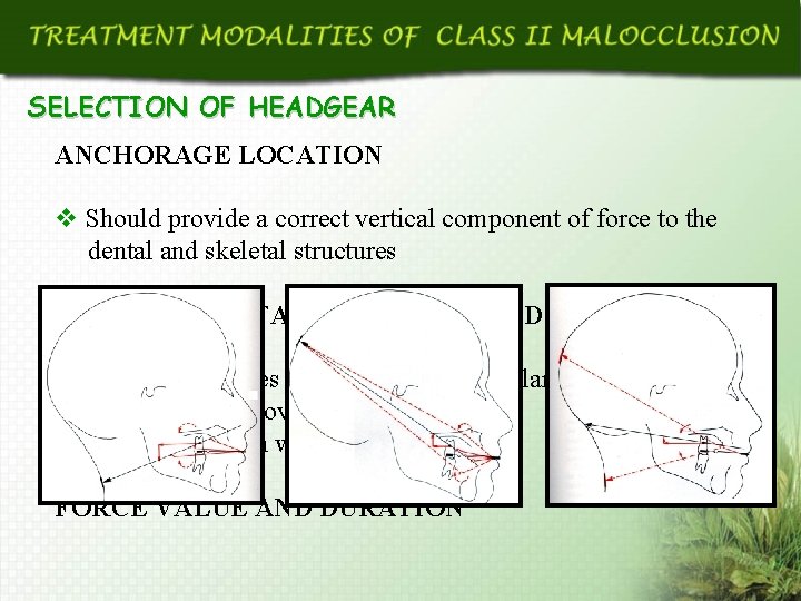 SELECTION OF HEADGEAR ANCHORAGE LOCATION v Should provide a correct vertical component of force