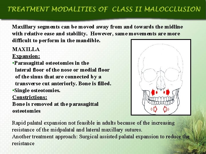 Maxillary segments can be moved away from and towards the midline with relative ease