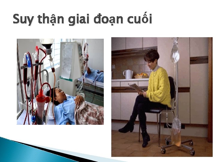 Suy thận giai đoạn cuối 