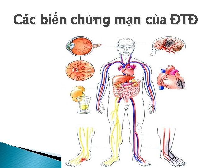 Các biến chứng mạn của ĐTĐ 