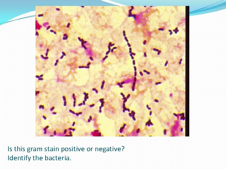 Is this gram stain positive or negative? Identify the bacteria. 