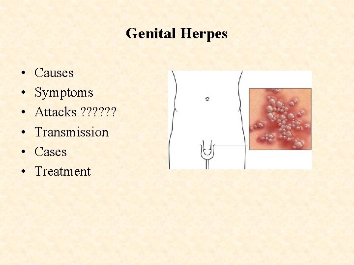 Genital Herpes • • • Causes Symptoms Attacks ? ? ? Transmission Cases Treatment