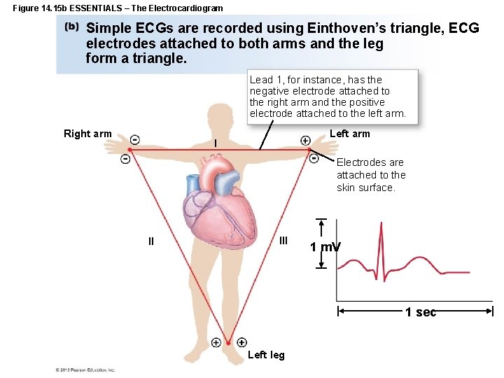 Figure 14. 15 b ESSENTIALS – The Electrocardiogram Simple ECGs are recorded using Einthoven’s