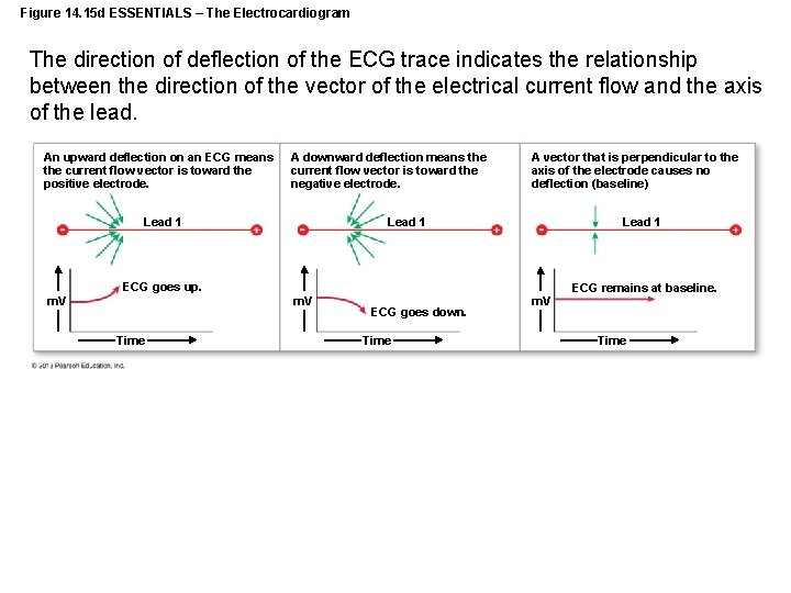 Figure 14. 15 d ESSENTIALS – The Electrocardiogram The direction of deflection of the