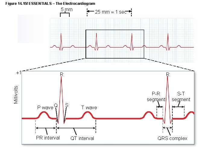 Figure 14. 15 f ESSENTIALS – The Electrocardiogram 5 mm Millivolts 1 25 mm
