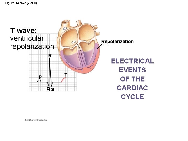 Figure 14. 16 -7 (7 of 8) T wave: ventricular repolarization R T P