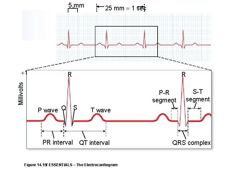 5 mm Millivolts 1 25 mm 1 sec R R P-R segment P wave