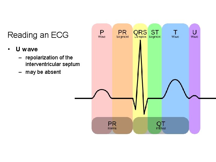 Reading an ECG • U wave – repolarization of the interventricular septum – may