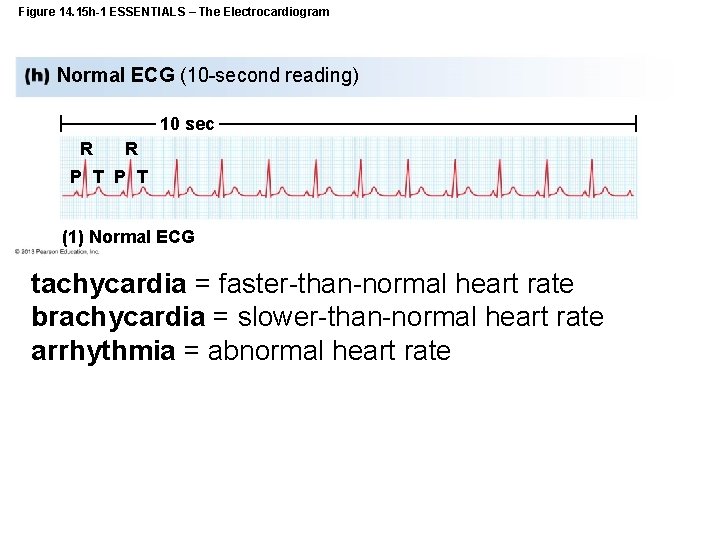 Figure 14. 15 h-1 ESSENTIALS – The Electrocardiogram Normal ECG (10 -second reading) 10