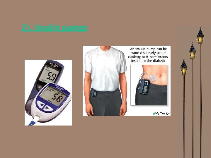 2). Insulin pumps 