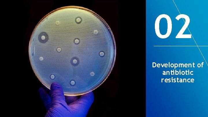 02 Development of antibiotic resistance 