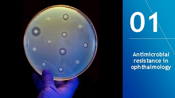 01 Antimicrobial resistance in ophthalmology 