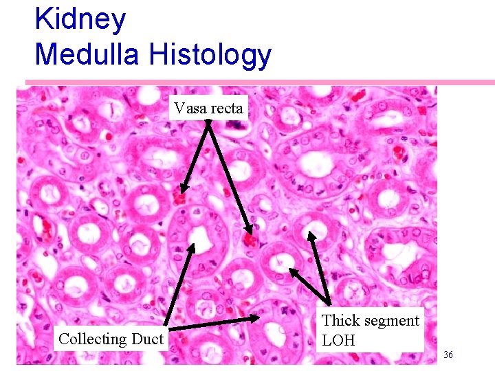 Kidney Medulla Histology Vasa recta Collecting Duct Thick segment LOH 36 