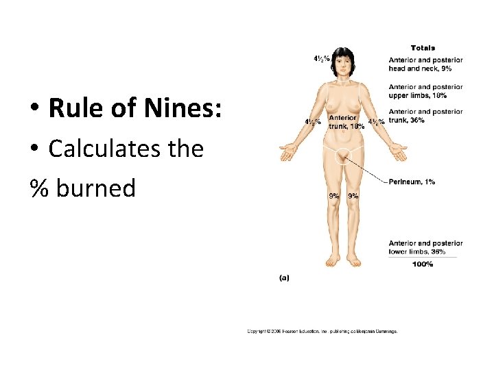  • Rule of Nines: • Calculates the % burned 