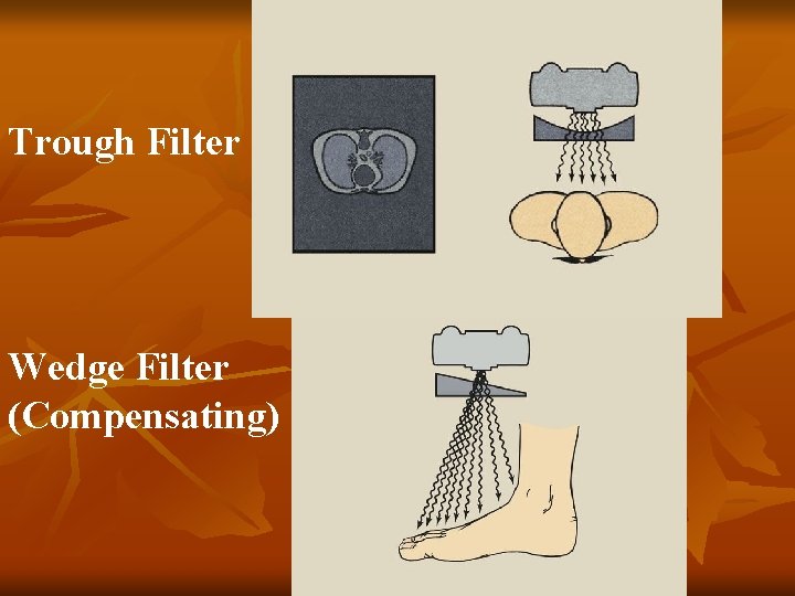 Trough Filter Wedge Filter (Compensating) 