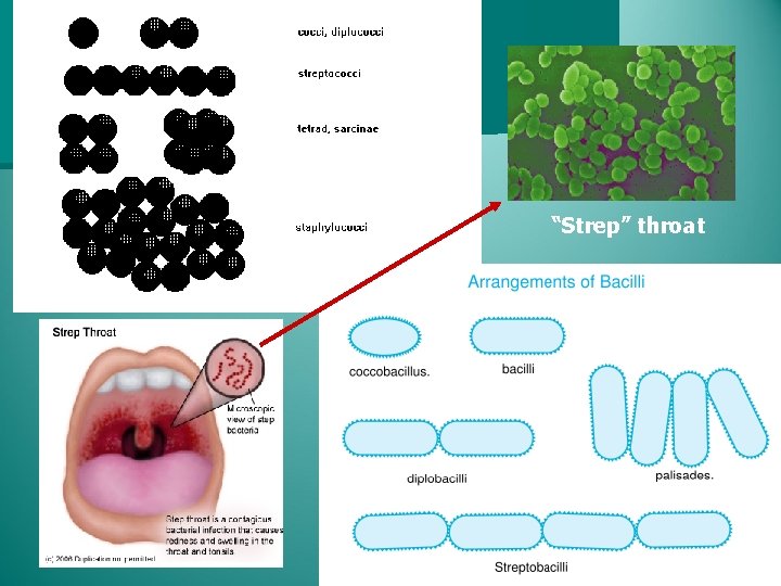 “Strep” throat 