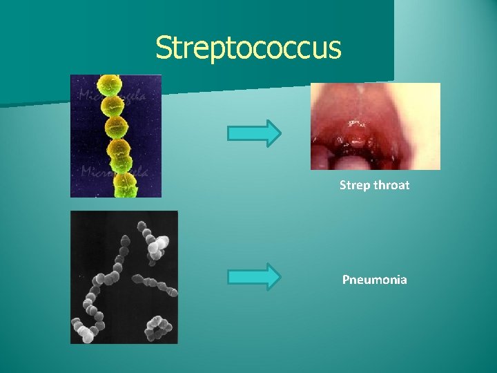 Streptococcus Strep throat Pneumonia 
