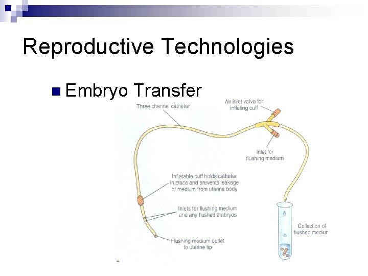 Reproductive Technologies n Embryo Transfer 