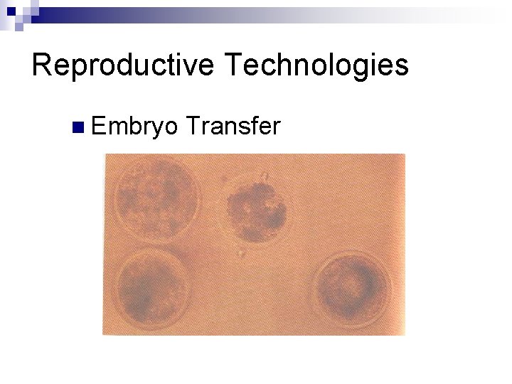 Reproductive Technologies n Embryo Transfer 