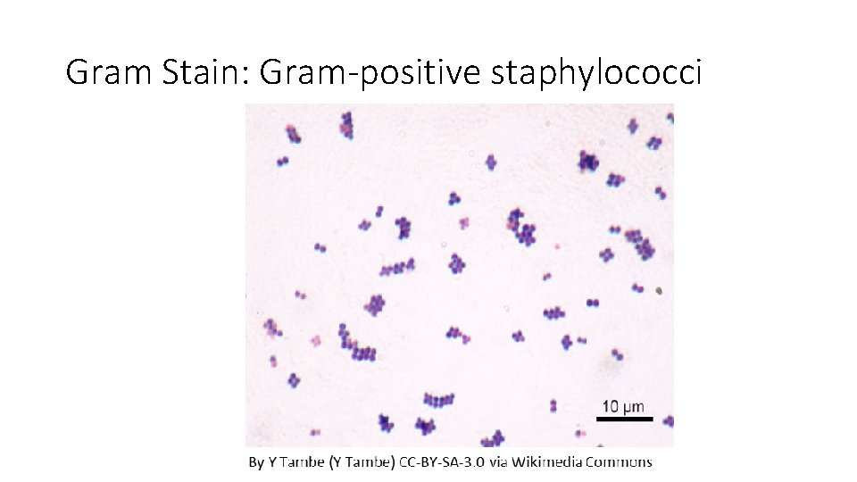 Gram Stain: Gram-positive staphylococci 