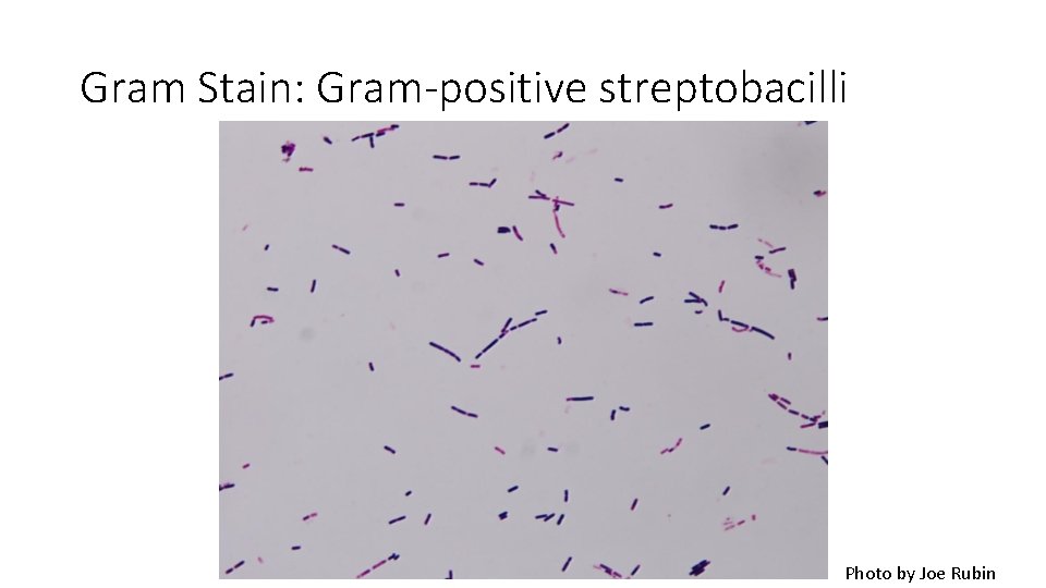 Gram Stain: Gram-positive streptobacilli Photo by Joe Rubin 