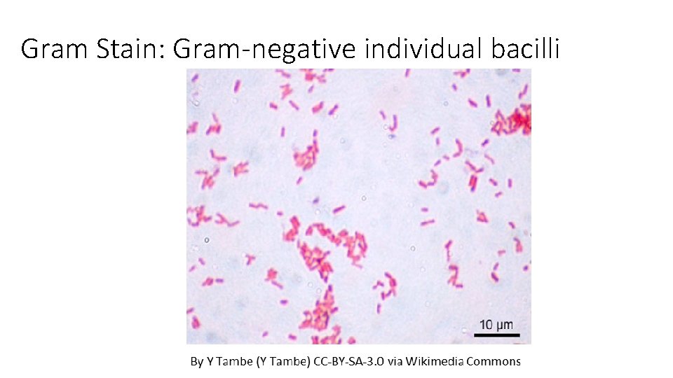 Gram Stain: Gram-negative individual bacilli 